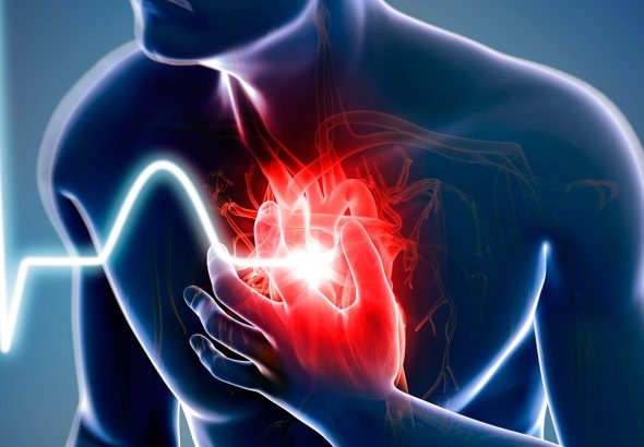heart attack