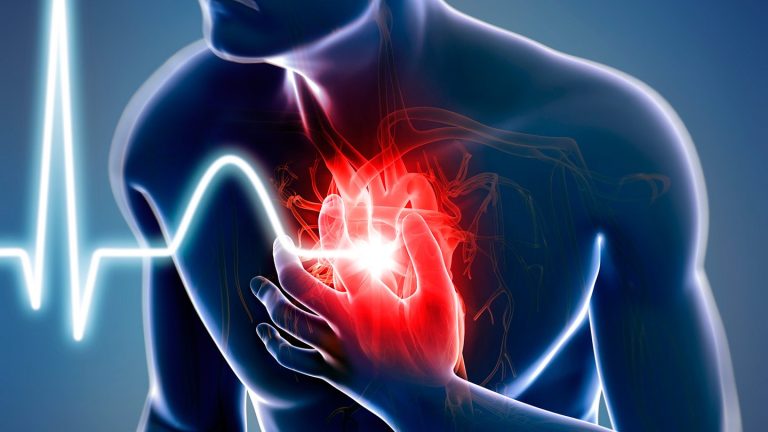heart attack